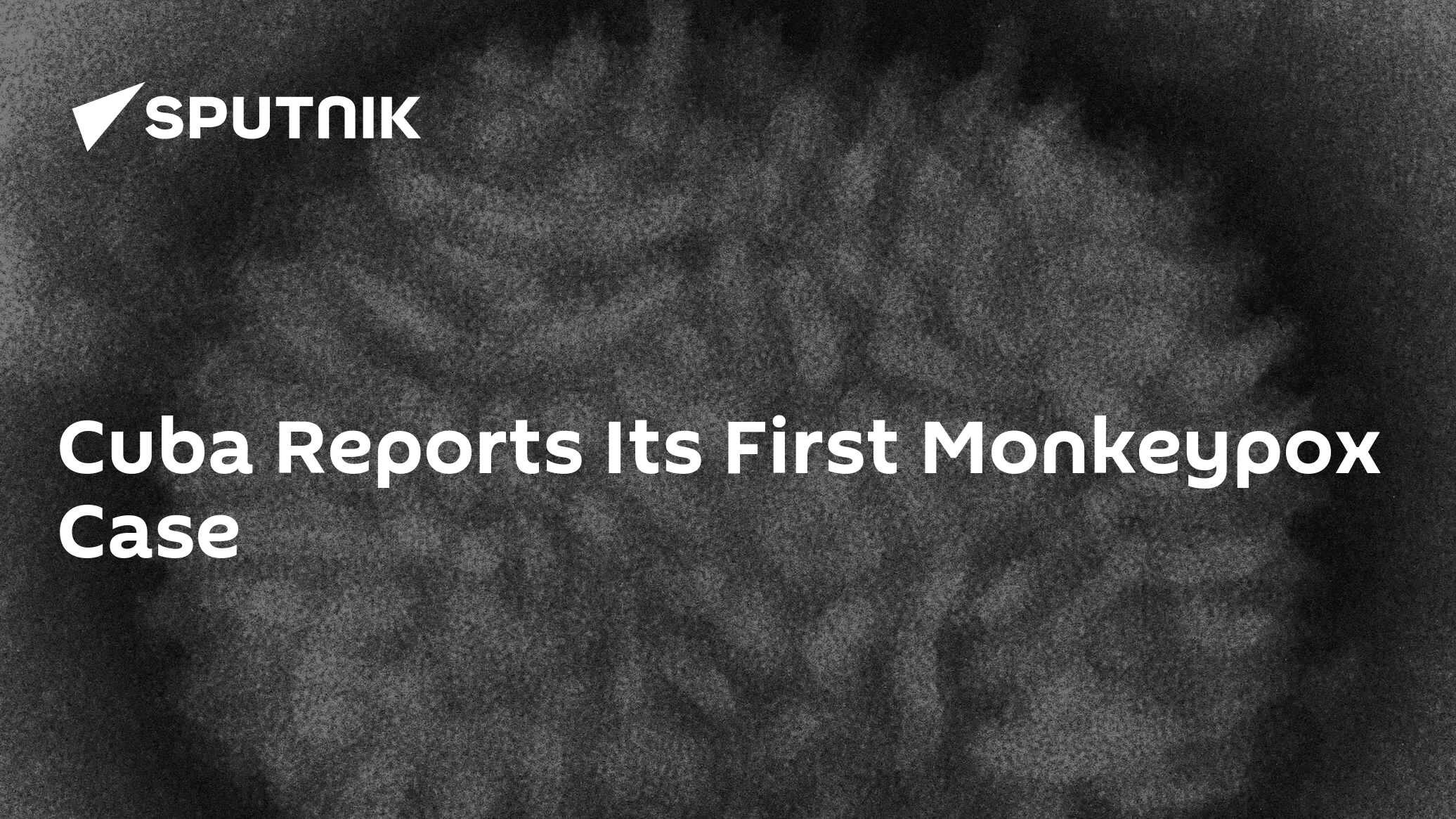 Cuba Reports Its First Monkeypox Case - 21.08.2022, Sputnik International