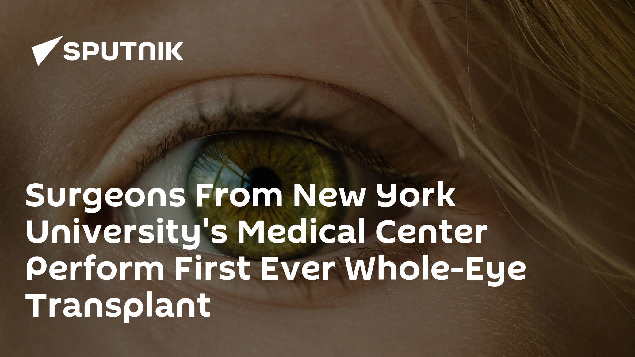 Surgeons From New York University's Medical Center Perform First Ever Whole-Eye Transplant