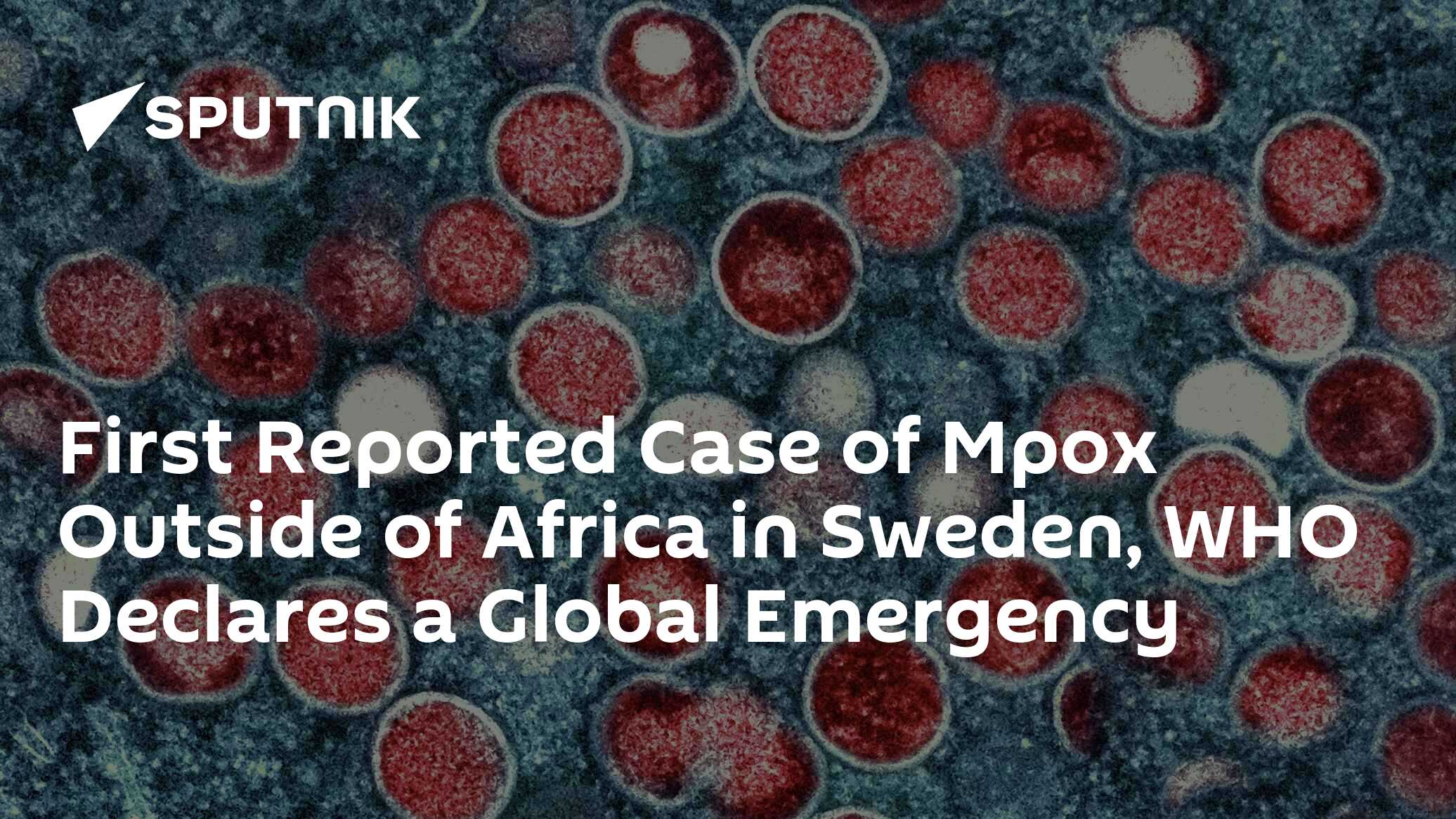 First Reported Case Of Mpox Outside Of Africa In Sweden, WHO Declares A ...