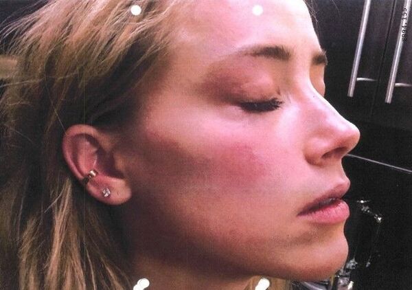 Amber Heard Denies Having Affair With Elon Musk Or Faking Injuries And Insists Johnny Depp Hit Her - Sputnik International