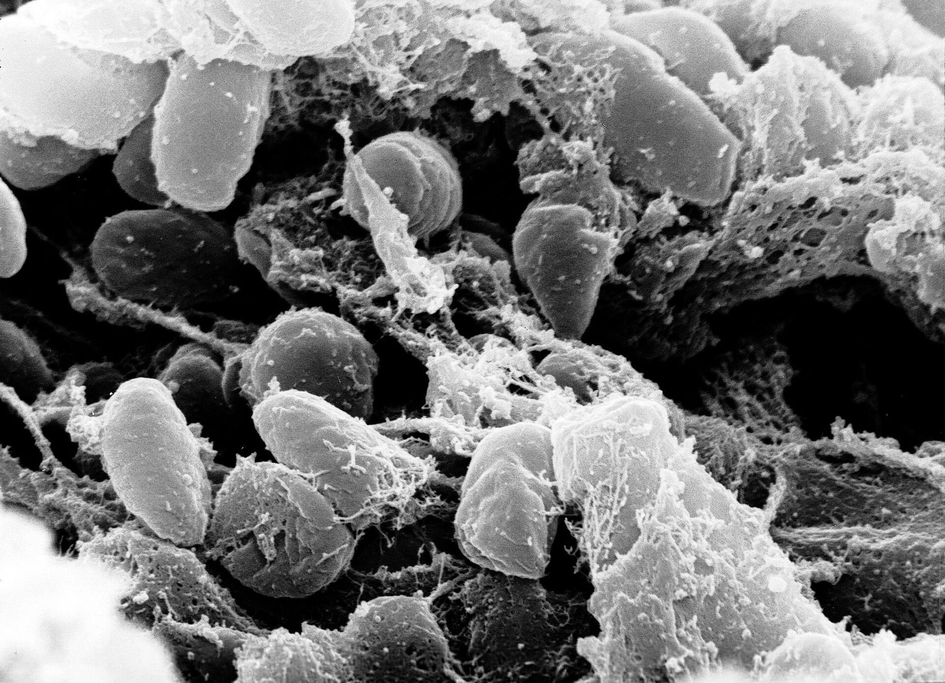 Scanning electron micrograph depicting a mass of Yersinia pestis bacteria - Sputnik International, 1920, 07.08.2022