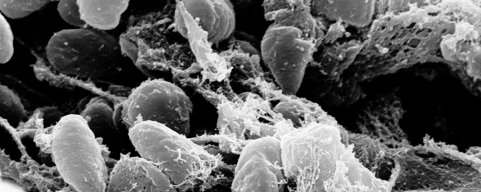 Scanning electron micrograph depicting a mass of Yersinia pestis bacteria - Sputnik International, 1920, 16.06.2022