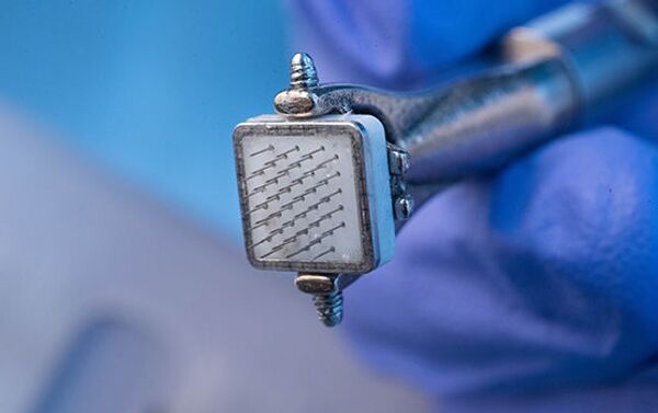 Photos: Researchers Develop Cortical Implant to Restore Vision for Blind People - Sputnik International