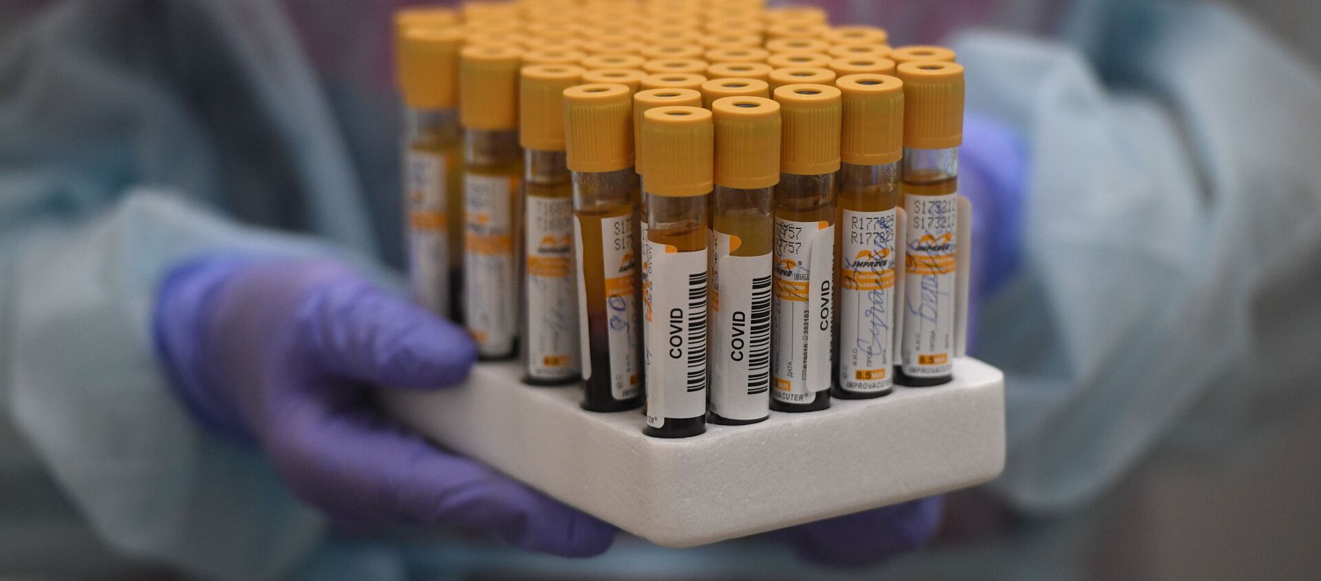 Testing for COVID-19 antibodies in Moscow, Russia - Sputnik International, 1920