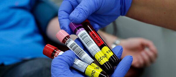 Blood samples donated by recovered novel coronavirus patients for plasma extraction, contributing to Israel's new experimental antibodies treatment, are collected by Magen David Adom’s Blood Services in Sheba Medical Center Hospital near Tel Aviv, on June 1, 2020. Blood samples donated by recovered novel coronavirus patients for plasma extraction, contributing to Israel's new experimental antibodies treatment, are collected by Magen David Adom’s Blood Services in Sheba Medical Center Hospital near Tel Aviv, on June 1, 2020. - Sputnik International