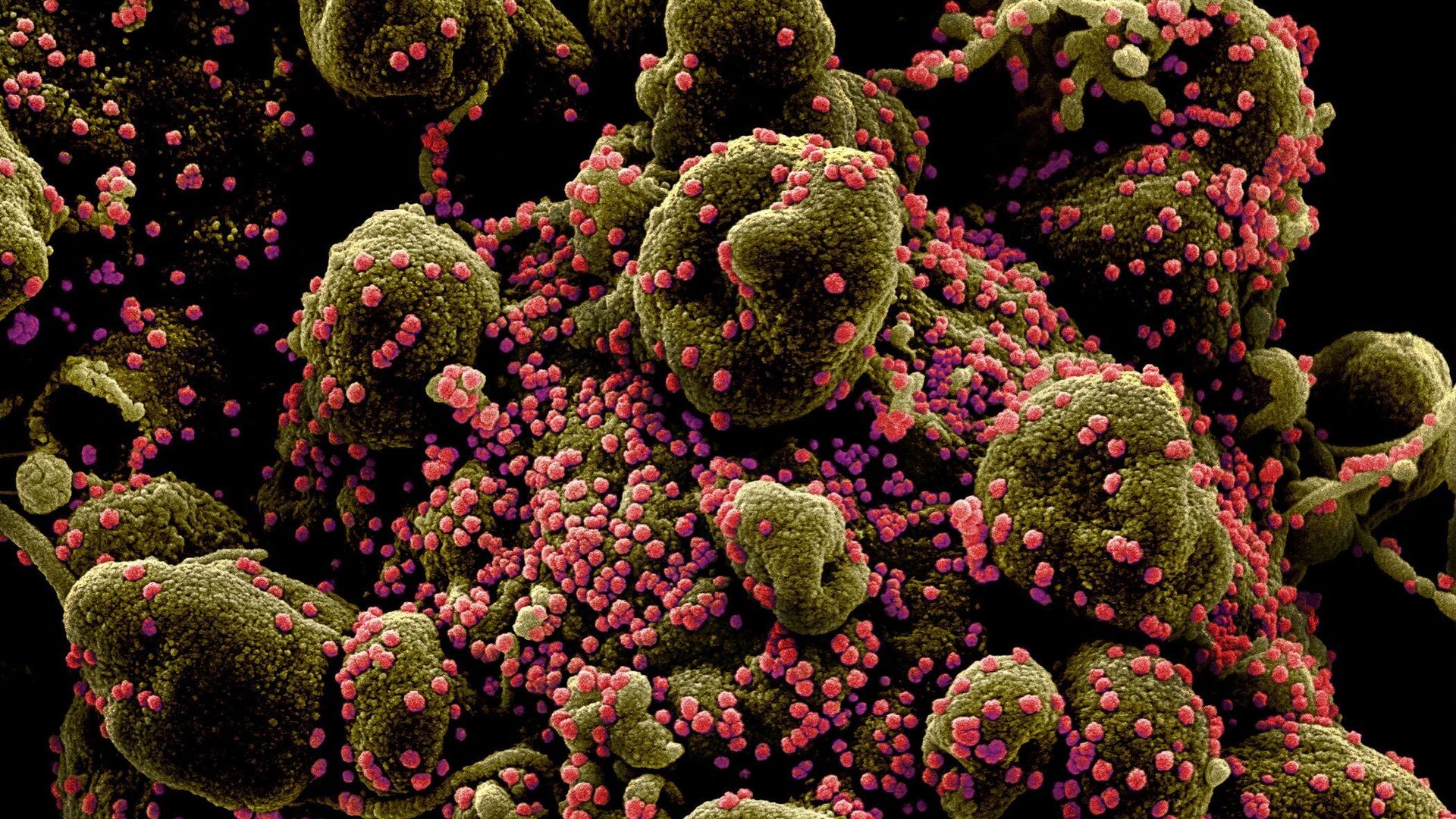 Colourized scanning electron micrograph of an apoptotic cell (greenish-brown) heavily infected with SARS-COV-2 virus particles (pink), also known as novel coronavirus, isolated from a patient sample. Image captured and colour-enhanced at the NIAID Integrated Research Facility (IRF) in Fort Detrick, Maryland. - Sputnik International, 1920, 22.07.2021