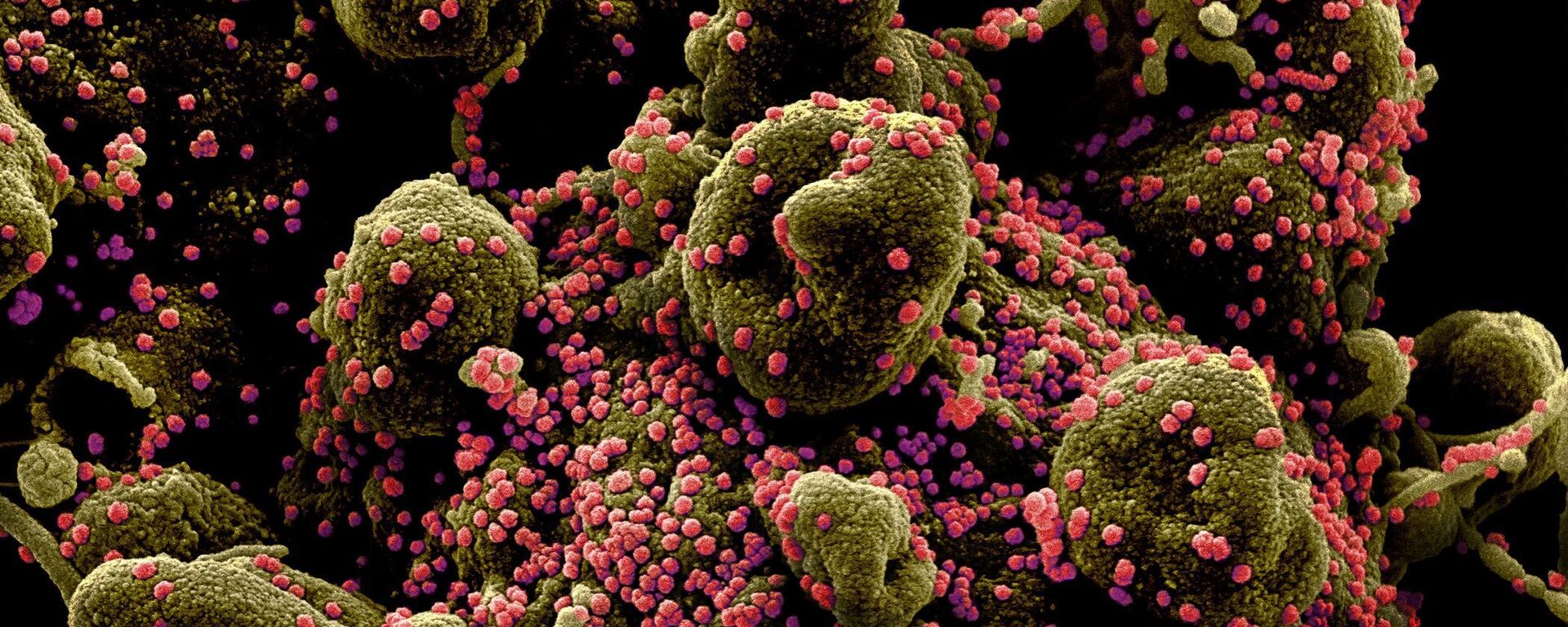 Colourized scanning electron micrograph of an apoptotic cell (greenish-brown) heavily infected with SARS-COV-2 virus particles (pink), also known as novel coronavirus, isolated from a patient sample. Image captured and colour-enhanced at the NIAID Integrated Research Facility (IRF) in Fort Detrick, Maryland. - Sputnik International, 1920, 28.10.2022