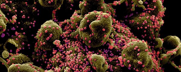 Colourized scanning electron micrograph of an apoptotic cell (greenish-brown) heavily infected with SARS-COV-2 virus particles (pink), also known as novel coronavirus, isolated from a patient sample. Image captured and colour-enhanced at the NIAID Integrated Research Facility (IRF) in Fort Detrick, Maryland. - Sputnik International