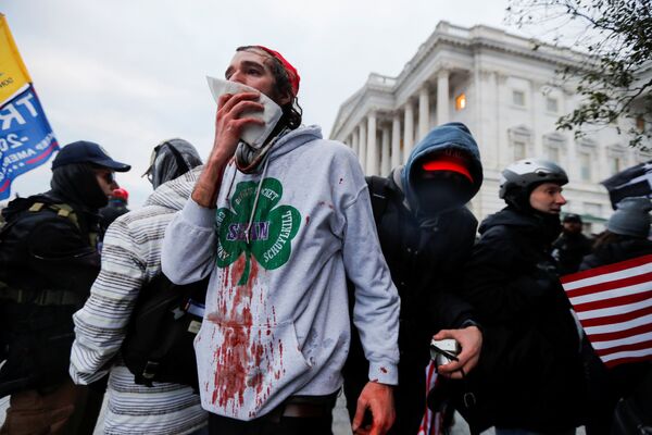 SENSITIVE MATERIAL. THIS IMAGE MAY OFFEND OR DISTURB An injured supporter of US President Donald Trump reacts during a protest against the certification of the 2020 US presidential election results by the U.S. Congress, outside the US Capitol in Washington, 6 January 2021 - Sputnik International