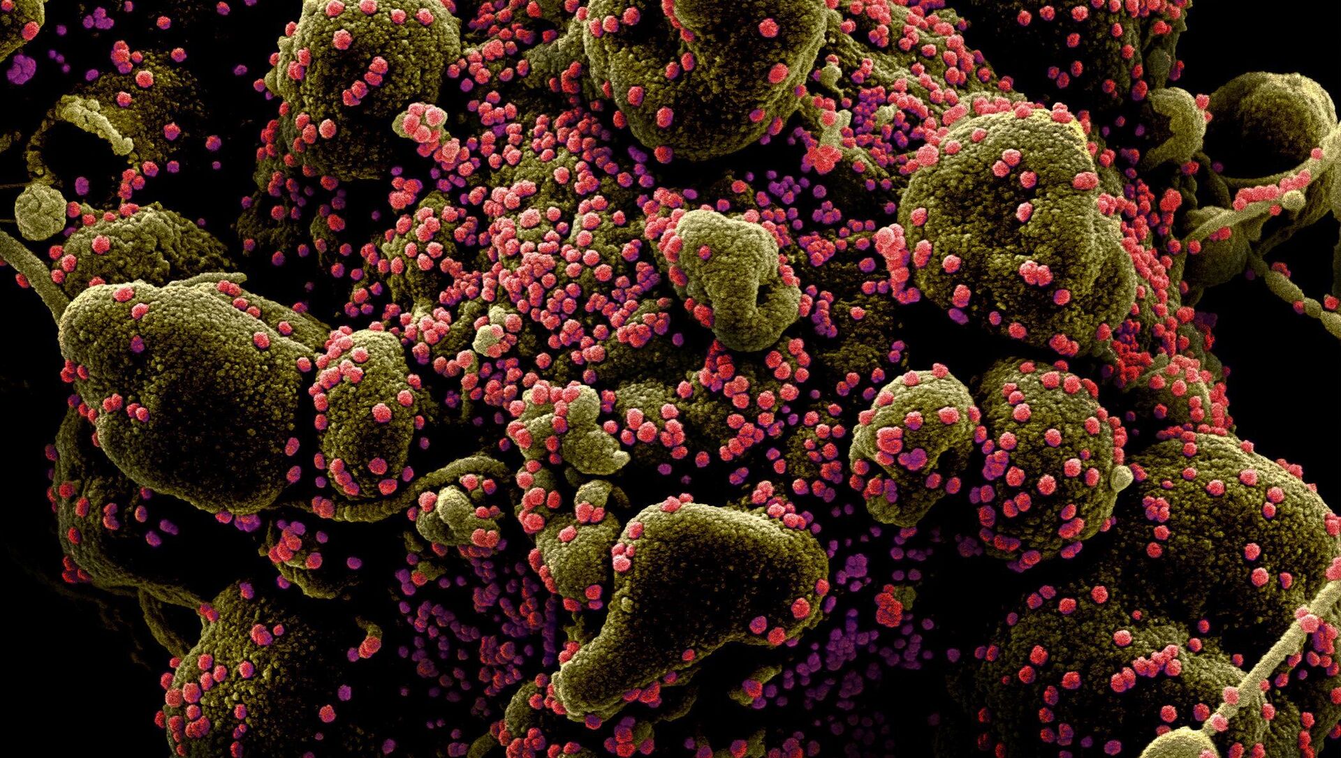 Colorized scanning electron micrograph of an apoptotic cell (greenish brown) heavily infected with SARS-COV-2 virus particles (pink), also known as novel coronavirus, isolated from a patient sample. Image captured and color-enhanced at the NIAID Integrated Research Facility (IRF) in Fort Detrick, Maryland.  - Sputnik International, 1920, 15.02.2021