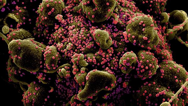 Colorized scanning electron micrograph of an apoptotic cell (greenish brown) heavily infected with SARS-COV-2 virus particles (pink), also known as novel coronavirus, isolated from a patient sample. Image captured and color-enhanced at the NIAID Integrated Research Facility (IRF) in Fort Detrick, Maryland.  - Sputnik International
