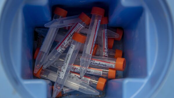 Nasal swab samples collected from suspected COVID -19 patients are seen inside a container before conducting COVID-19 RT-PCR Test - Sputnik International