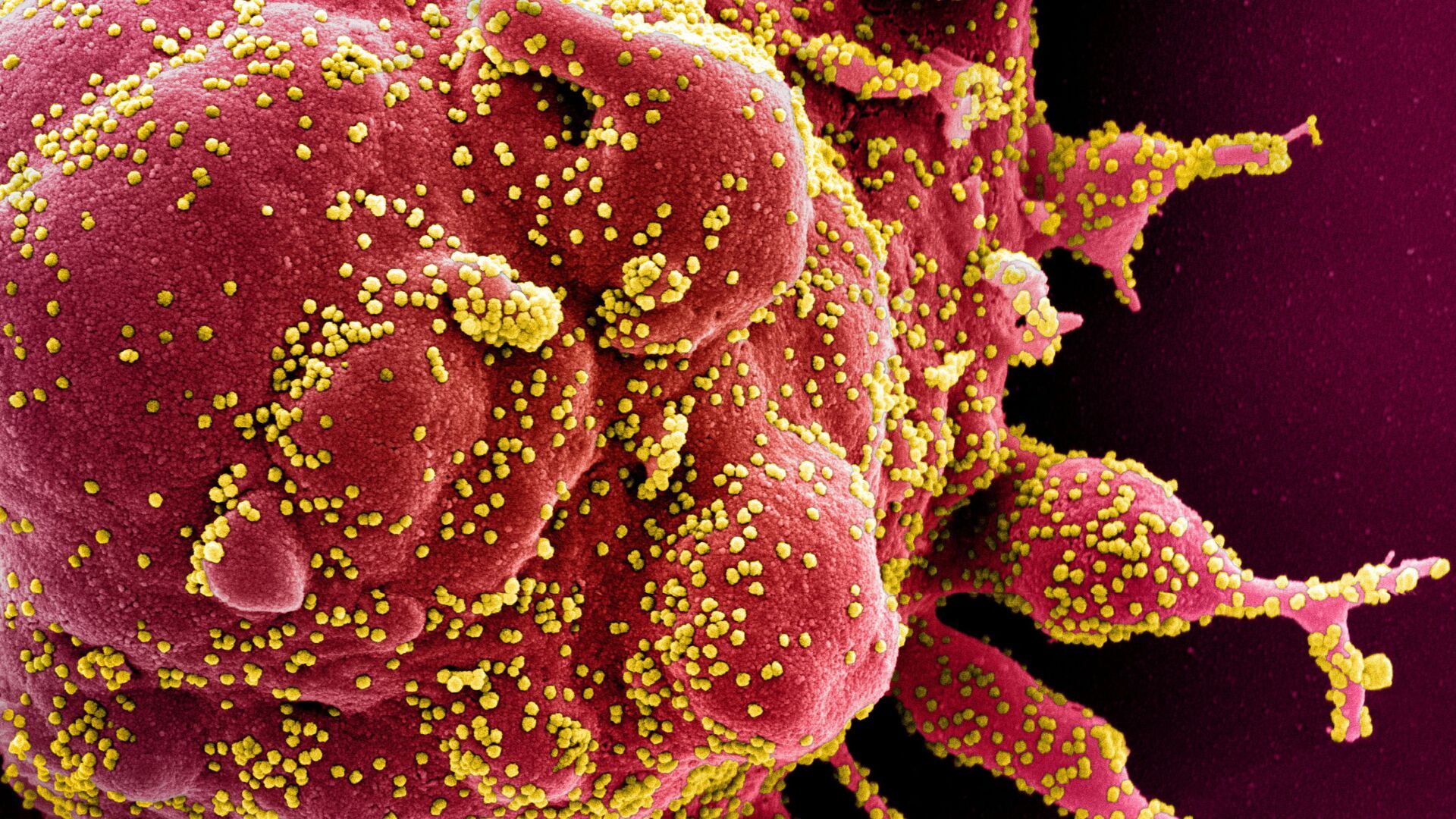 Colorized scanning electron micrograph of an apoptotic cell (red) infected with SARS-COV-2 virus particles (yellow), also known as novel coronavirus, isolated from a patient sample. Image captured at the NIAID Integrated Research Facility (IRF) in Fort Detrick, Maryland - Sputnik International, 1920, 28.12.2021