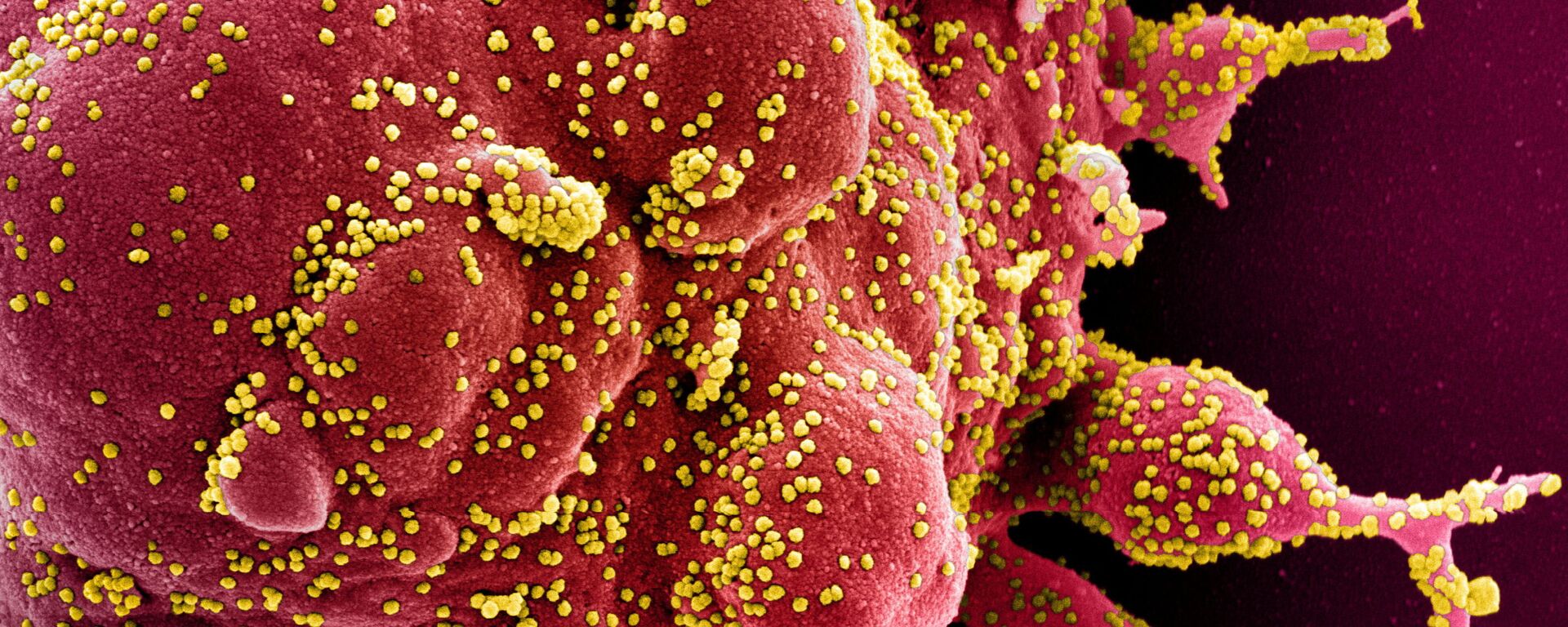 Colorized scanning electron micrograph of an apoptotic cell (red) infected with SARS-COV-2 virus particles (yellow), also known as novel coronavirus, isolated from a patient sample. Image captured at the NIAID Integrated Research Facility (IRF) in Fort Detrick, Maryland - Sputnik International, 1920, 26.11.2021