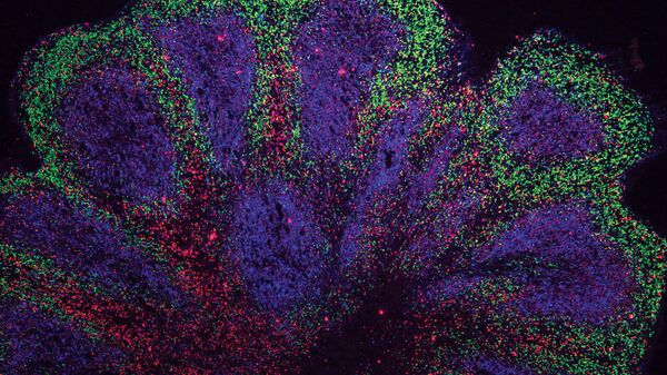 Lab-grown ‘mini brains’ hint at treatments for neurodegenerative diseases - Sputnik International