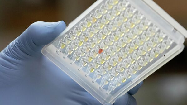 Daniel Streblow, Ph.D., holds a plate of plasma samples that contain COVID-19 antibodies, to be evaluated in OHSUХs in-house COVID-19 testing lab.  - Sputnik International