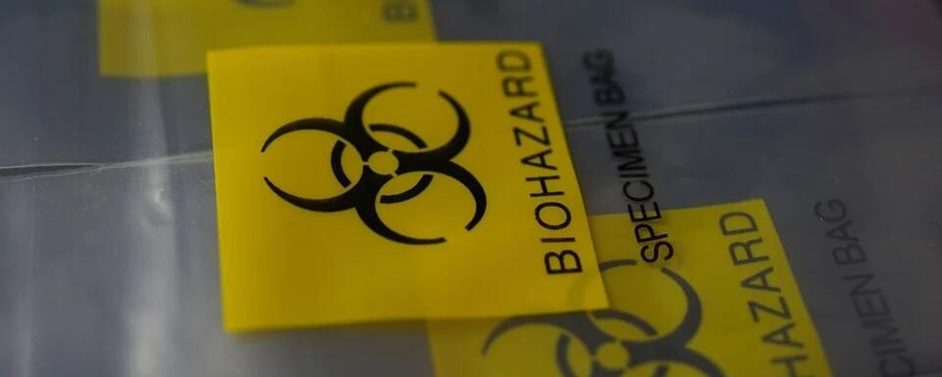 Biohazard
, - Sputnik International, 1920, 06.05.2023