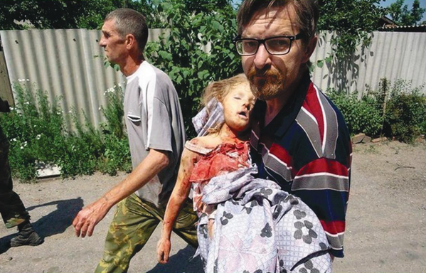 8 June 2014. A five-year-old girl falls victim to shelling in the village of Semyonovka. - Sputnik International