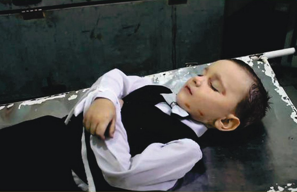 27 January 2015, Donetsk. Four-year-old Sasha died during an artillery attack by the Ukrainian Armed Forces. A shell fragment hit him in the back. - Sputnik International