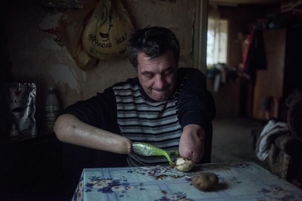 51-year-old Yuri Yanush, who lost both arms before the war, peels potatoes. He lives in the village of Gurty outside the city of Donetsk. Single people with handicaps have no one to depend on, and have no hope of receiving normal medical care. Many cannot find employment. Regular shelling is the reality in which people who already live difficult lives even in times of peace are forced to exist. - Sputnik International
