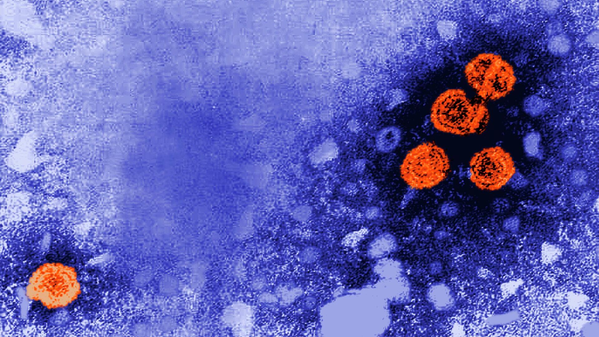 This 1981 electron microscope image made available by the U.S. Centers for Disease Control and Prevention shows hepatitis B virus particles, indicated in orange. - Sputnik International, 1920, 06.05.2022