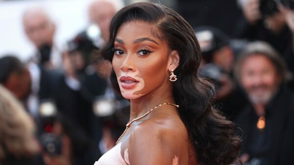 Winnie Harlow poses for photographers upon arrival at the premiere of the film 'Elvis' at the 75th international film festival, Cannes, southern France, Wednesday, May 25, 2022 - Sputnik International