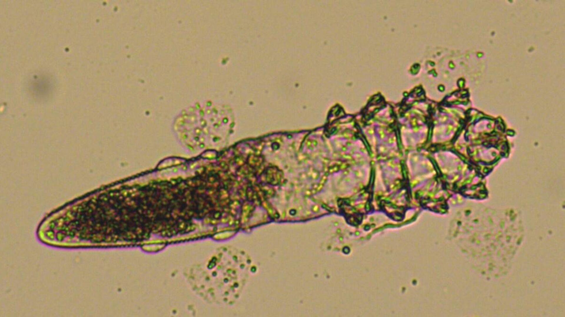 Dermatological human parasite mite Demodex follicularum - Sputnik International, 1920, 22.06.2022