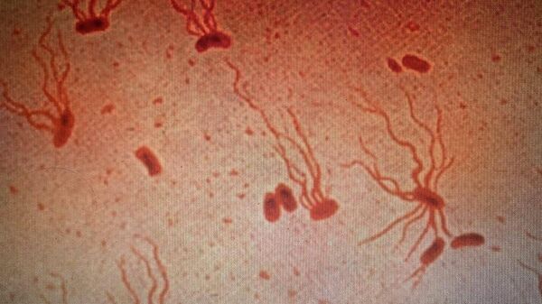 Salmonella enterica serovar Typhi flagellar stain - Sputnik International