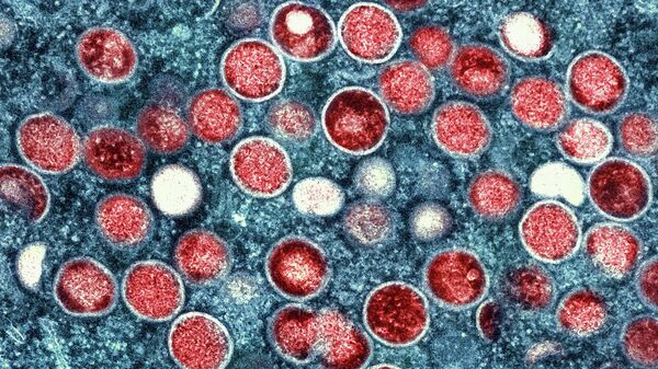   Colorized transmission electron micrograph of monkeypox particles (File) - Sputnik International