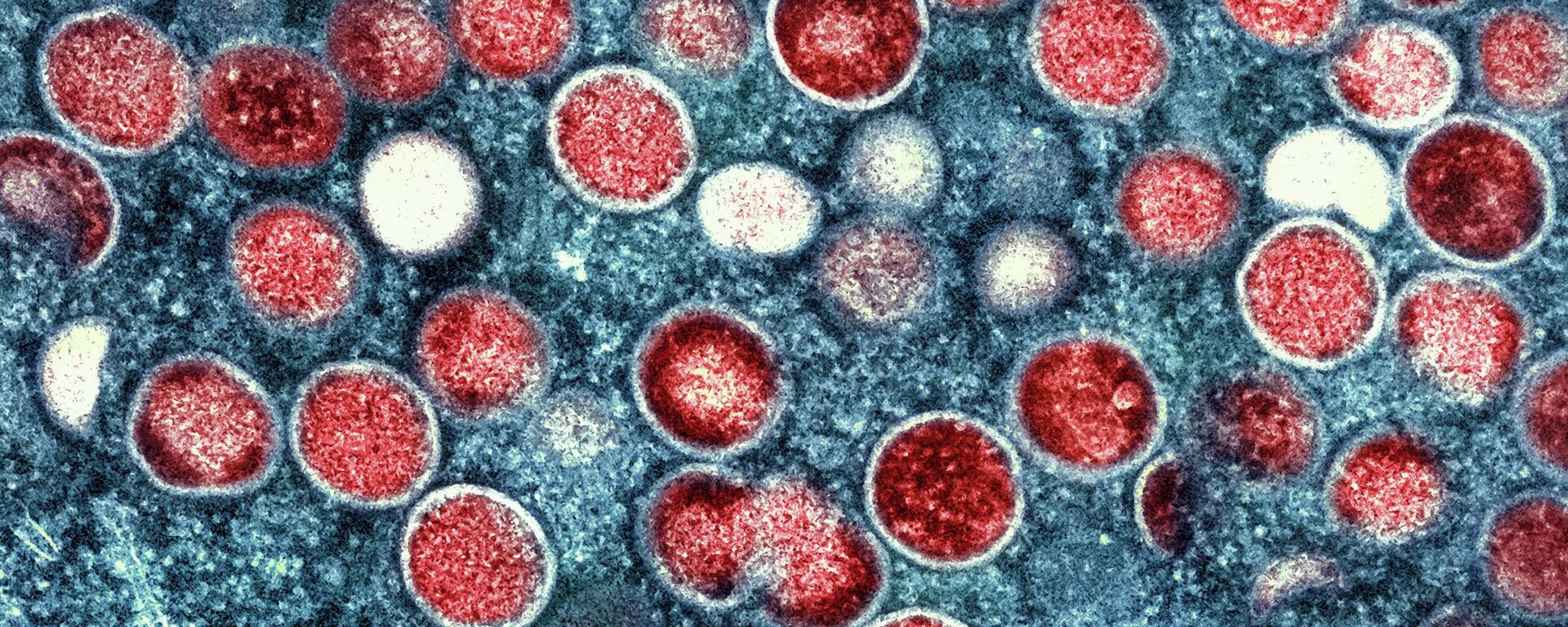   Colorized transmission electron micrograph of monkeypox particles (File) - Sputnik International, 1920, 02.09.2022