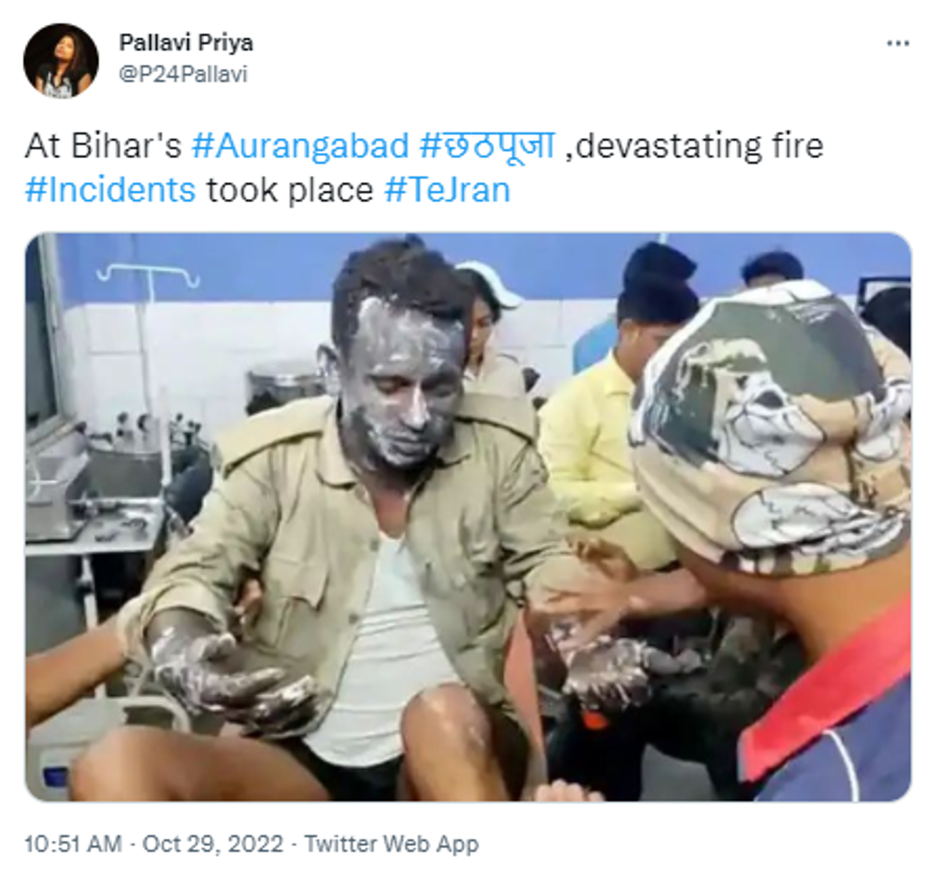 Screenshot of Twitter post of an injured man undergoing treatment after he suffered severe burns post gas cylinder blasted in India's Bihar state - Sputnik International, 1920, 29.10.2022