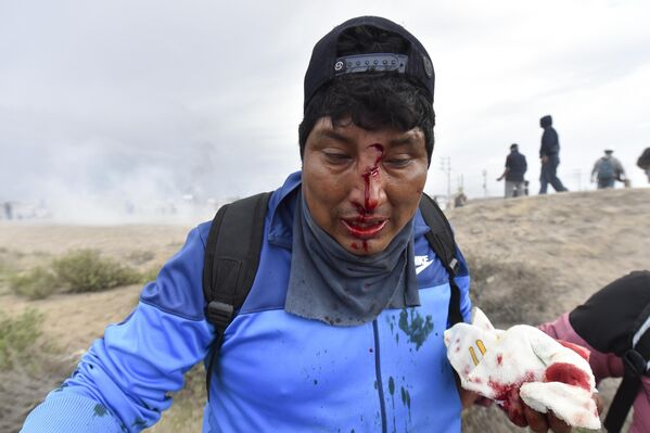 People aid a man injured during anti-government protests in Arequipa, Peru, Thursday, January 19, 2023.  - Sputnik International