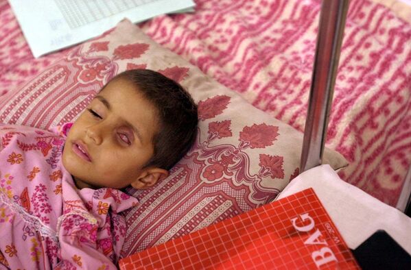 Four-year-old Alla Saleem, who suffers from a tumor in her eye, lies on her bed as she waits for medication at the Ghazwan Children&#x27;s Hospital in the southern Iraqi town of Basra, about 60 kilometers (37 miles) from the border with Kuwait. Iraqi authorities claim that about 300 tons of bombs with depleted uranium were used by the allied forces during the Gulf War bombing campaign, and this caused the increase of cancer cases in the area.  According to Doctor Jawal Al-Ali, chief cancer consultant of the Basra teaching hospital and member of the Royal College of Physicians in London, these cases have multiplied by 12 since 1991. - Sputnik International