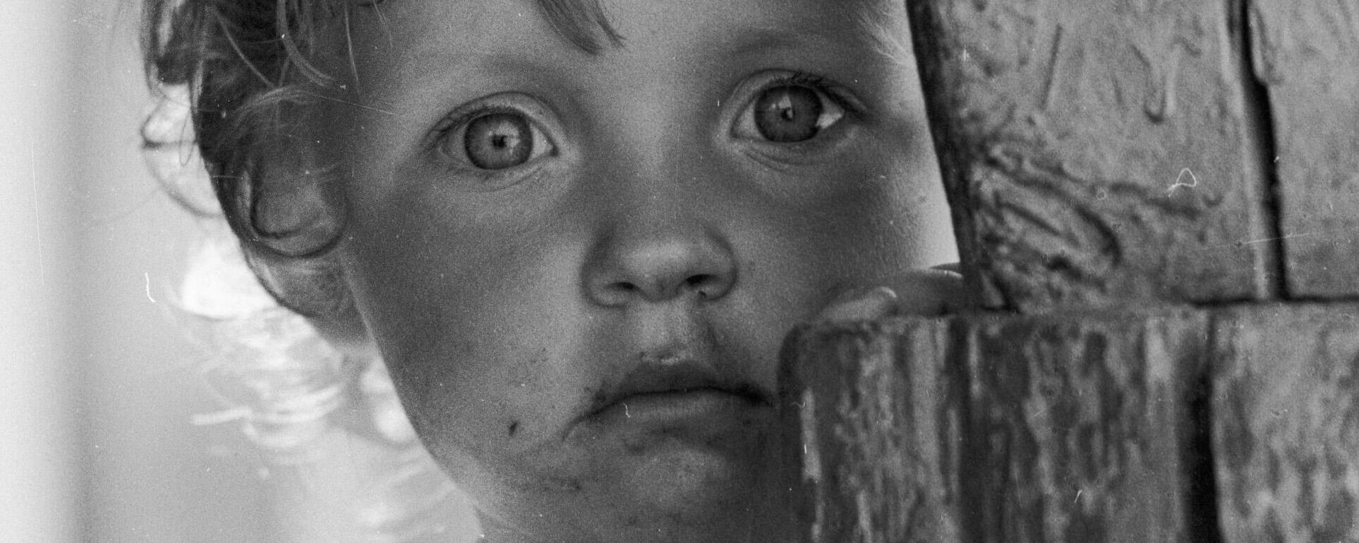 A child from the village of Chudyany, affected by radiation as a result of the Chernobyl accident. - Sputnik International, 1920, 26.04.2023