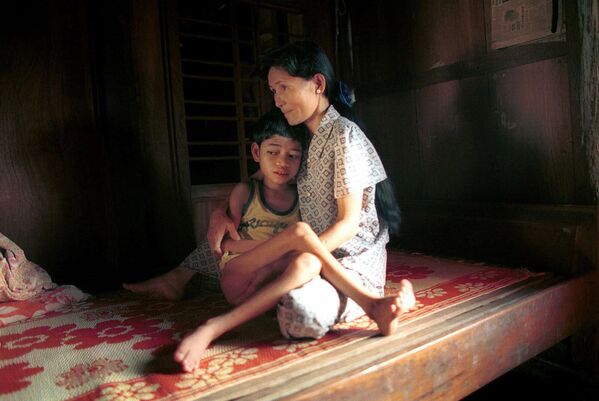 Twelve-year-old Pham Quoc Huy is comforted by his mother on a bamboo cot in their home near his village of Dong Son, in the central highlands of Vietnam. Pham is suffering from what his parents say are the effects of the jungle defoliant Agent Orange, used heavily in the region by the US armed forces during the Vietnam War.  - Sputnik International