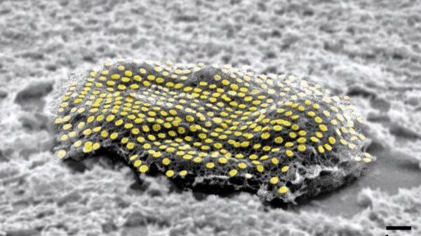 mouse fibroblast dotted with gold nanodots. - Sputnik International