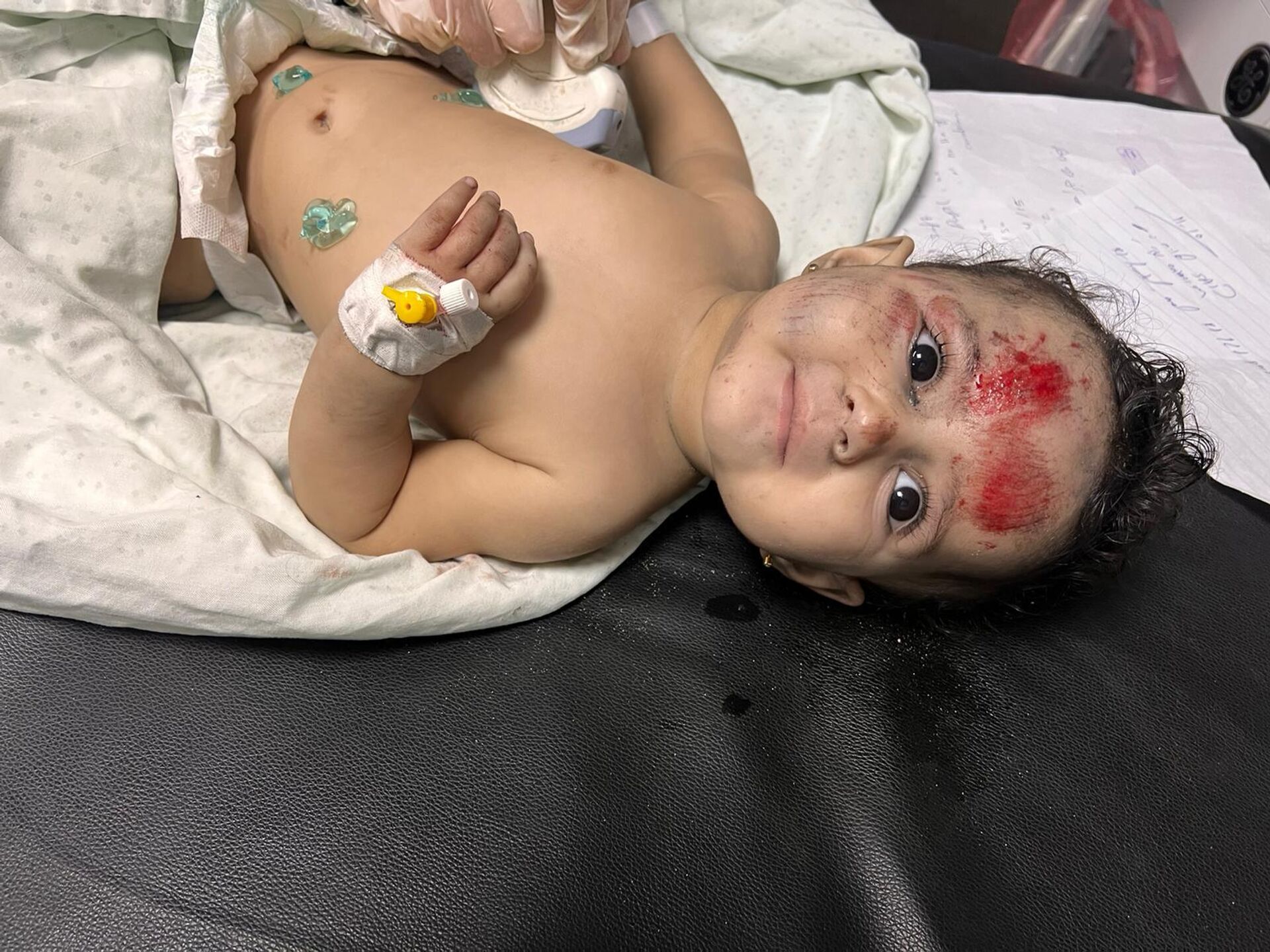 An injured child in Al Shifaa hospital, Gaza - Sputnik International, 1920, 26.10.2023