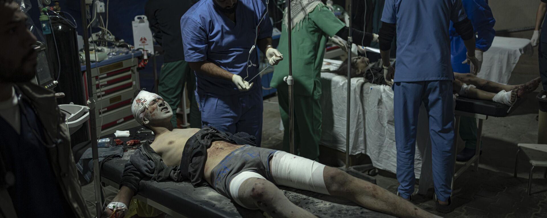 Палестинцы, раненые в результате израильской бомбардировки сектора Газа, прибывают в больницу в Рафахе - Sputnik International, 1920, 30.06.2024
