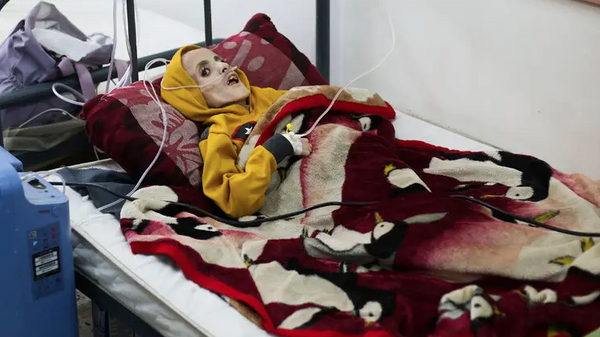 Yazan Kafarneh on his hospital bed in Rafah, southern Gaza, on Sunday. By Monday, he was dead. - Sputnik International