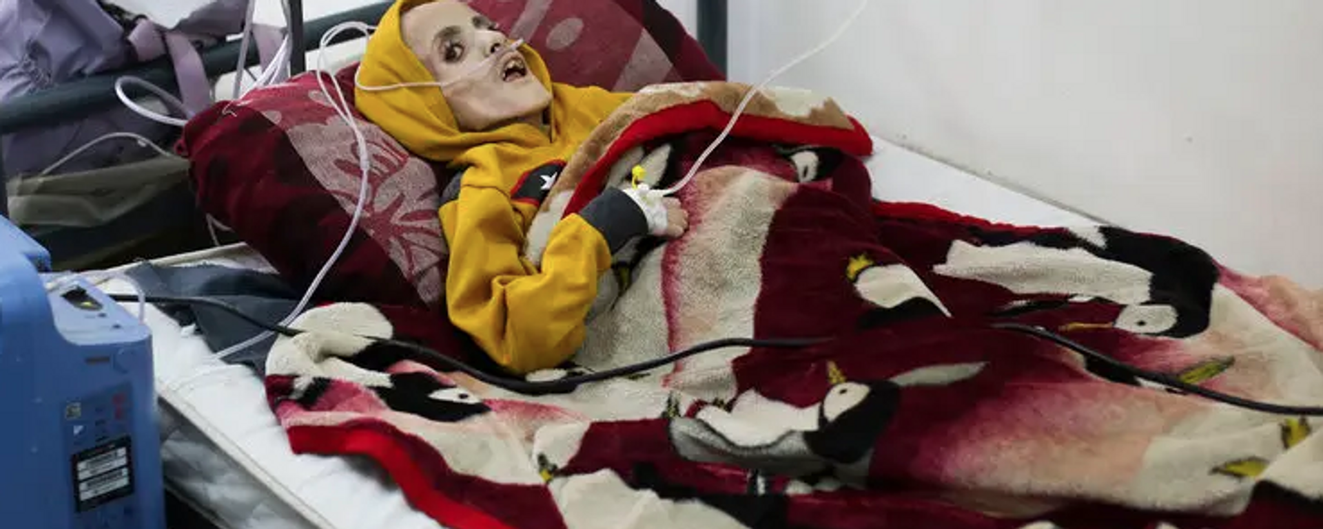 یازان کفرنه روز یکشنبه بر روی تخت بیمارستانی در رفح، جنوب غزه.  تا دوشنبه مرده بود.  - اسپوتنیک بین المللی، 1920، 10.03.2024