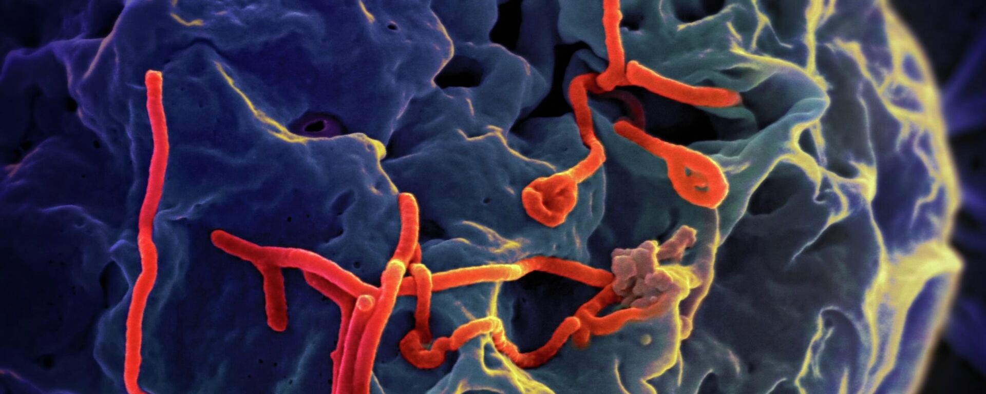 Ebola virus under the microscope - Sputnik International, 1920, 20.09.2022