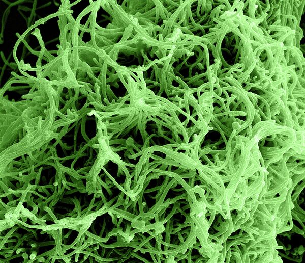 Colorized scanning electron micrograph of filamentous Ebola virus particles budding from a chronically infected VERO E6 cell - Sputnik International