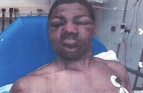 On Wednesday, five Rikers guards and one captain were fired over the 2012 beating of mentally ill inmate, Robert Hinton, pictured here. On Wednesday, five Rikers guards and one captain were fired over the 2012 beating of mentally ill inmate, Robert Hinton, pictured here. - Sputnik International