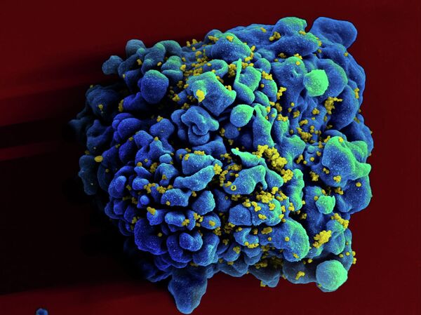 HIV-infected H9 T cell HIV-infected H9 T cell - Sputnik International