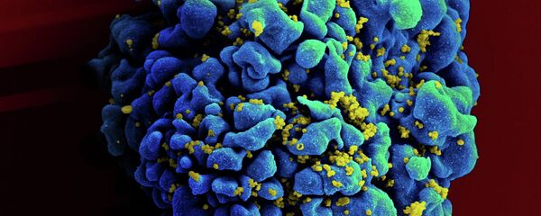 HIV-infected H9 T cell HIV-infected H9 T cell - Sputnik International