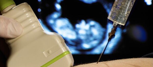 Pregnant woman - Sputnik International