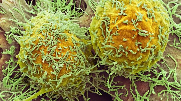 Liver cancer cells - Sputnik International
