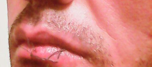 An asylum seeker is pictured with his lips sewn together in this handout picture provided by the refugee action coalition, taken inside the Manus Island detention centre in Papua New Guinea January 13, 2015. An asylum seeker is pictured with his lips sewn together in this handout picture provided by the refugee action coalition, taken inside the Manus Island detention centre in Papua New Guinea January 13, 2015. - Sputnik International