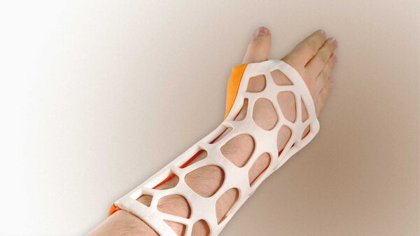 3D printed plastic casts and splints 3D printed plastic casts and splints - Sputnik International