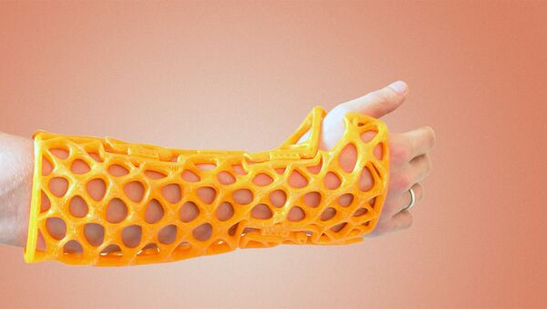 3D printed plastic casts and splints - Sputnik International